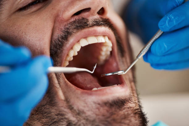 Best Emergency Tooth Extraction in Lone Jack, MO